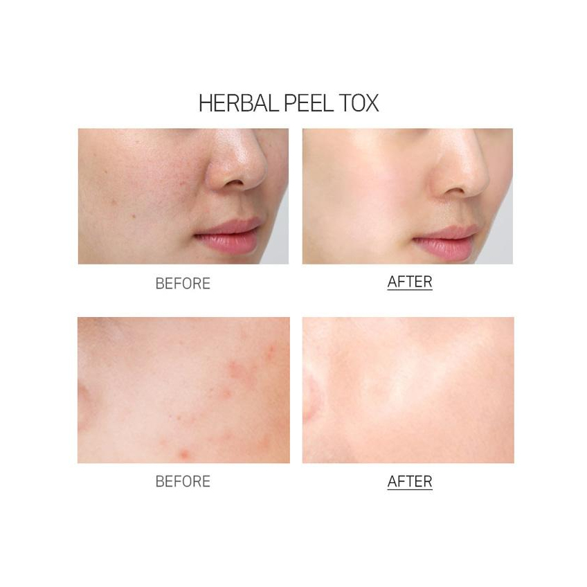 Успокаивающая пилинг-маска с эффектом детокса Medi-Peel Herbal Peel Tox