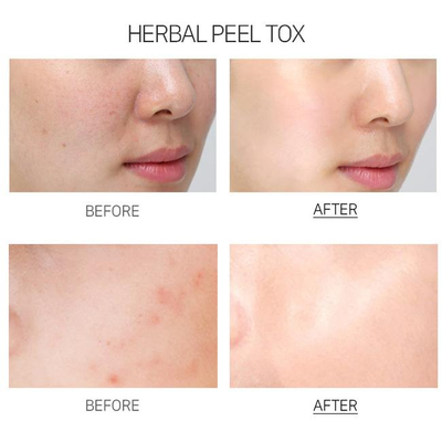 Успокаивающая пилинг-маска с эффектом детокса Medi-Peel Herbal Peel Tox